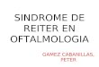 Sindrome de Reiter en Oftalmologia