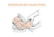 Distocias de Causa Fetal