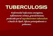 Clase 5 Tuberculosis