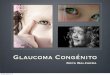 Glaucoma Congénito