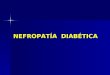 NEFROPATÍA DIABÉTICA. NEFROPATÌA DIABÈTICA DEFINICIÒN NEFROPATÌA DIABÈTICA DEFINICIÒN La N.D. es una complicación microvascular de la Diabetes Mellitus