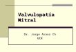 Valvulopatía Mitral Dr. Jorge Arauz ChUCR. Estenosis Mitral diástole sístole Orificio normal es de 4 a 6 cm2; tiene forma de embudo