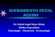 SFA SUFRIMIENTO FETAL AGUDO Dr. Rafael Angel Moya Sibaja Médico Especialista Ginecología - Obstetricia - Perinatología