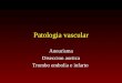 Patologia vascular Aneurisma Diseccion aortica Trombo embolia e infarto