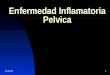 30/01/20141 Enfermedad Inflamatoria Pelvica. 30/01/20142 Infecciones Pelvicas Las infecciones pueden ocurrir en cualquiera o en todas las porciones de
