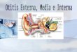 Está formado por : Oído externo, medio e interno. Está formado por : Oído externo, medio e interno