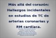 Más allá del corazón: Hallazgos incidentales en estudios de TC de arterias coronarias y RM cardíaca. Lourdes Hernández Muñoz Carmen Soteras Roura Beatriz