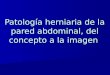 Patología herniaria de la pared abdominal, del concepto a la imagen