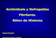 Amiloidosis y Nefropatias Fibrilares. Riñon de Mieloma Eduardo Hernández Hospital 12 de Octubre. Madrid