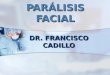 PARÁLISIS FACIAL DR. FRANCISCO CADILLO. DEFINICIÓN DE PARÁLISIS FACIAL Es la pérdida total del movimiento muscular voluntario de un lado de la cara. El