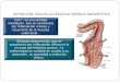 DEFINICIÓN; COLITIS ULCERATIVA CRÓNICA INESPECÍFICA CUCI : es una entidad nosológica que se caracteriza por inflamación crónica y recurrente de la mucosa