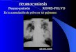 Neumoconiosis Neumo-pulmón KONIS-POLVO Es la acumulación de polvo en los pulmones