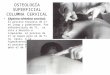 OSTEOLOGÍA SUPERFICIAL COLUMNA CERVICAL Séptima vértebra cervical: El proceso espinoso de C7 es largo y prominente. Par diferenciarlo de T1, se rota a