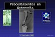 Procedimientos en Ortopedia DIEGO PIAZZA 11 Septiembre 2008 Árbol de Andry