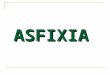 ASFIXIA. Asfixia hipoxia anoxia es la anulación completa del oxigeno, cuando la persona estando en condiciones físicas normales no tiene concentraciones