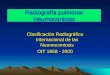 Radiografía pulmonar Neumoconiosis Clasificación Radiográfica Internacional de las Neumoconiosis OIT 1958 - 2000