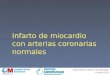 Infarto de miocardio con arterias coronarias normales Julián Palacios Rubio, R2 Cardiología Octubre 2012