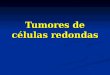 Tumores de células redondas. Sarcoma Ewing/PNET Sarcoma Ewing/PNET Neuroblastoma Neuroblastoma Rabdomiosarcoma Rabdomiosarcoma Linfoma Linfoblástico Linfoma