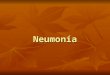 Neumonía. Definición Inflamación del parénquima pulmonar causada por un agente infeccioso