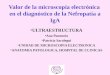 Valor de la microscopía electrónica en el diagnóstico de la Nefropatía a IgA ULTRAESTRUCTURA Ana Panuncio Patricia Saralegui UNIDAD DE MICROSCOPIA ELECTRONICA