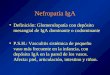 Nefropatía IgA Definición: Glomerulopatía con depósito mesangial de IgA dominante o codominante P.S.H.: Vasculitis sistémica de pequeño vaso más frecuente