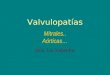 Valvulopatías Mitrales.. Aórticas… Dra. Liz Fatecha