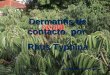 Dermatitis de contacto por Rhus Typhina Dra. Marcela Evangelista