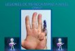 LESIONES DE MUÑECA/MANO A NIVEL OSEO. .INTRODUCCION Huesos: Entre las dos, la muñeca y la mano están compuestas de 29 huesos: diecinueve en la mano y