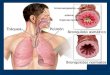 ASMA BRONQUIAL.- Definicion (73 palabras) El asma es una alteración inflamatoria crónica de la vía aérea en la que intervienen muchas células y elementos