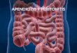APENDICITIS AGUDA INCIDENCIA Y EPIDEMIOLOGÍA Urgencia quirúrgica abdominal más común, C/año + de 250 000 apendicectomías. Frecuencia máxima: En el 2º