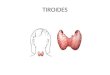 TIROIDES. HORMONAS TIROIDEAS Que son? El tiroides es una glándula situada en el cuello, su función es producir hormonas, la tiroxina (T4) y la triyodotironina