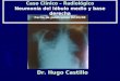 Caso Clínico – Radiológico Neumonía del lóbulo medio y base derecha Fecha de publicación 02/03/08 Dr. Hugo Castillo