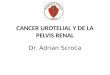 CANCER UROTELIAL Y DE LA PELVIS RENAL Dr. Adrian Scroca