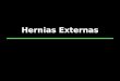 Hernias Externas. Hernia inguinal Es la hernia más frecuente de la pared abdominal. Ocurre en niños o en adultos Directas: mediales a los vasos epigástricos,