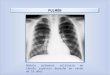 PULMÓN Nódulo pulmonar solitario en lóbulo superior derecho en varón de 16 años