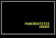 PANCREATITIS AGUDA. OBJETIVOS Fisiopatología Cuadro clínico Diagnóstico diferencial Estudios de laboratorio y gabinete Tratamiento médico y/o quirúrgico