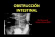 Dr. Marcos A Velasco Pérez RCG. Definición de Obstrucción Intestinal La obstrucción u oclusión intestinal constituye una identidad patológica bien definida