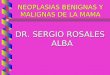 NEOPLASIAS BENIGNAS Y MALIGNAS DE LA MAMA DR. SERGIO ROSALES ALBA
