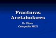 Fracturas Acetabulares Dr Pérez Ortopedia HCG. Tipicamente ocurren de gente joven, son secundarias a traumas de alta energia. Tipicamente ocurren de gente