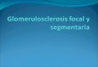Glomerulosclerosis focal y segmentaria