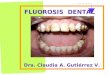 Patologia - Fluorosis Dental