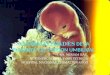 Anormalidades de la placenta y el cordon umbilical