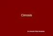 3 cirrosis
