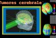 Modelo de presentacion de tumores cerebrales