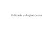 Urticaria y angioedema