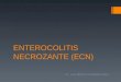 Enterocolitis necrozante