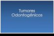Tumores odontogenicos 1