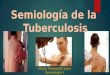 Semiología de la Tuberculosis