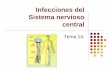 Tema 14. infecciones del sistema nervioso central