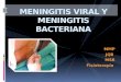 Meningitis viral y meningitis bacteriana